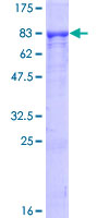 12.5% SDS-PAGE Stained with Coomassie Blue.